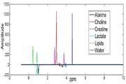 Accurate quantification of choline to creatine ratio as a biomarker to distinguish osteosarcoma patients from normal subjects employing proton magnetic resonance spectroscopy imaging at 3 tesla