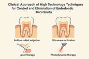 Clinical Approach of High Technology Techniques for Control and Elimination of Endodontic Microbiota