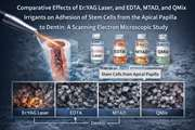Comparative effects of Er:YAG laser, and EDTA, MTAD, and QMix irrigants on adhesion of stem cells from the apical papilla to dentin: A scanning electron microscopic study